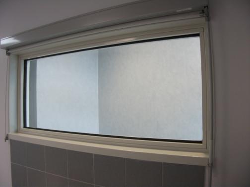 Universitätsklinikum Grenoble Alpes - Frankreich - Festes Röntgenschutzfenster mit 12 mm Blei. 